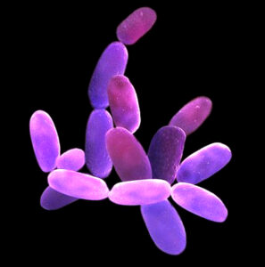 Read more about the article लवणजलरागी जीवाणू (Halophilic bacteria)