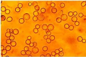 Read more about the article बुरशीचे बहुरूपकत्व आणि जैविक तंत्रज्ञान (Polymorphism & Biotechnology in Fungi)