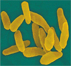Read more about the article घटसर्प (Diphtheria)