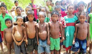 Read more about the article कुपोषण (Malnutrition)