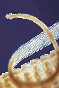 Read more about the article कृमी (Worm)