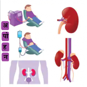 अपोहन (Dialysis)