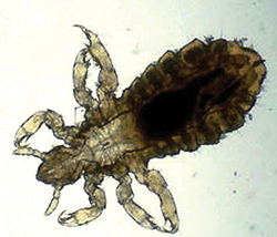 Read more about the article ऊ (Louse)