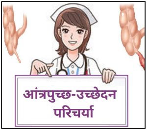 Read more about the article आंत्रपुच्छ-उच्छेदन परिचर्या (Appendectomy ‎Nursing)