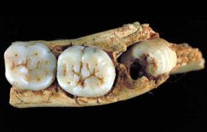 Read more about the article ॲन्टेसेसर मानव (Homo antecessor)